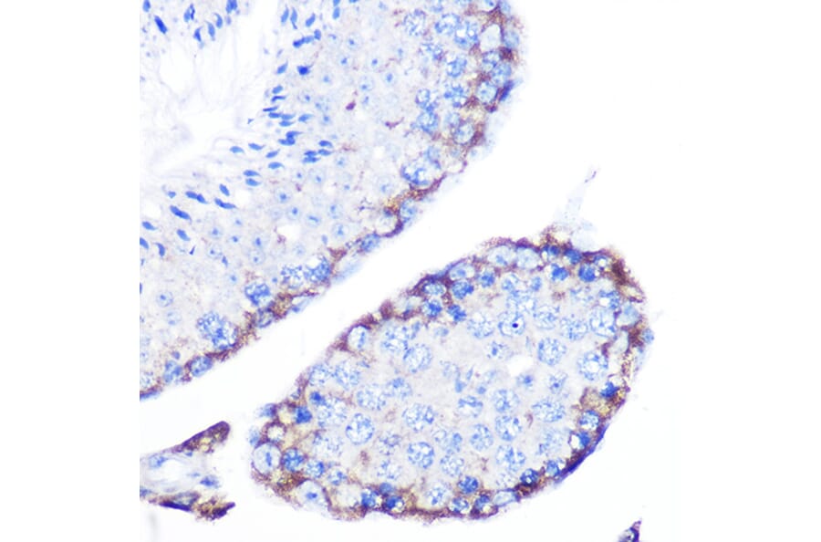 Immunohistochemistry - Anti-PMP70 Antibody (A306728) - Antibodies.com