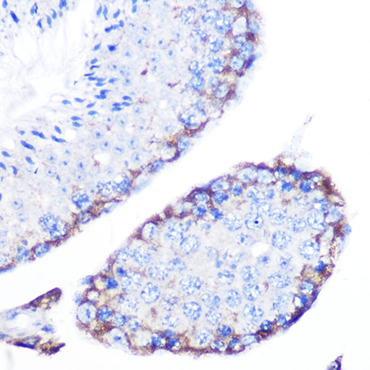 Immunohistochemistry - Anti-PMP70 Antibody (A306728) - Antibodies.com