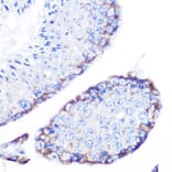 Immunohistochemistry - Anti-PMP70 Antibody (A306728) - Antibodies.com