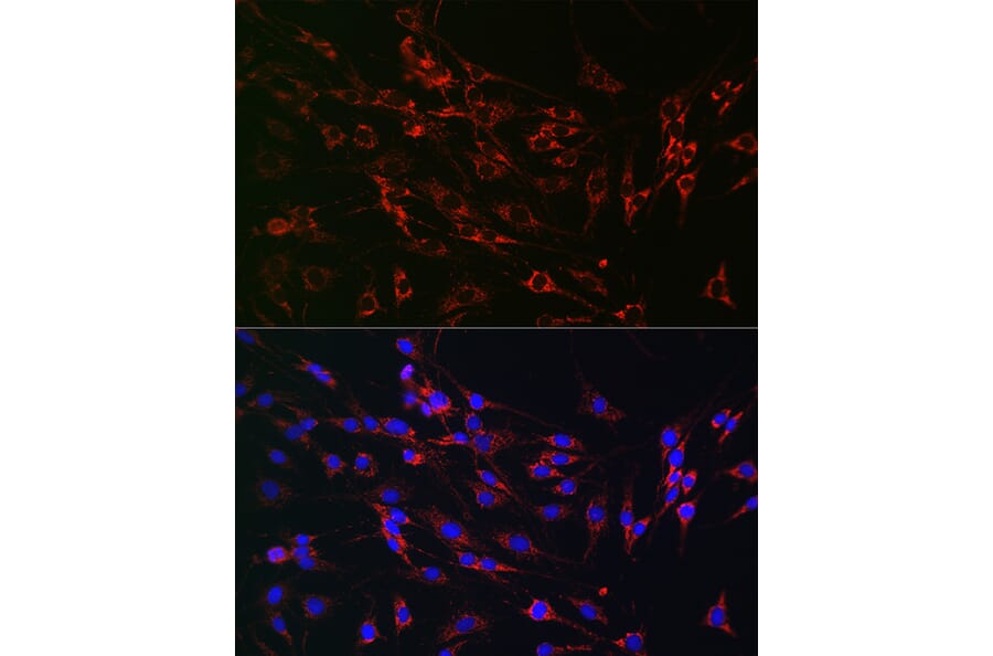 Immunofluorescence - Anti-PMP70 Antibody (A306728) - Antibodies.com