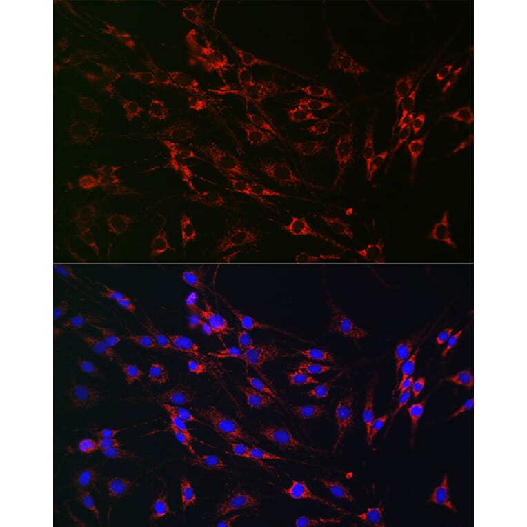 Immunofluorescence - Anti-PMP70 Antibody (A306728) - Antibodies.com