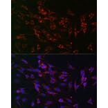 Immunofluorescence - Anti-PMP70 Antibody (A306728) - Antibodies.com