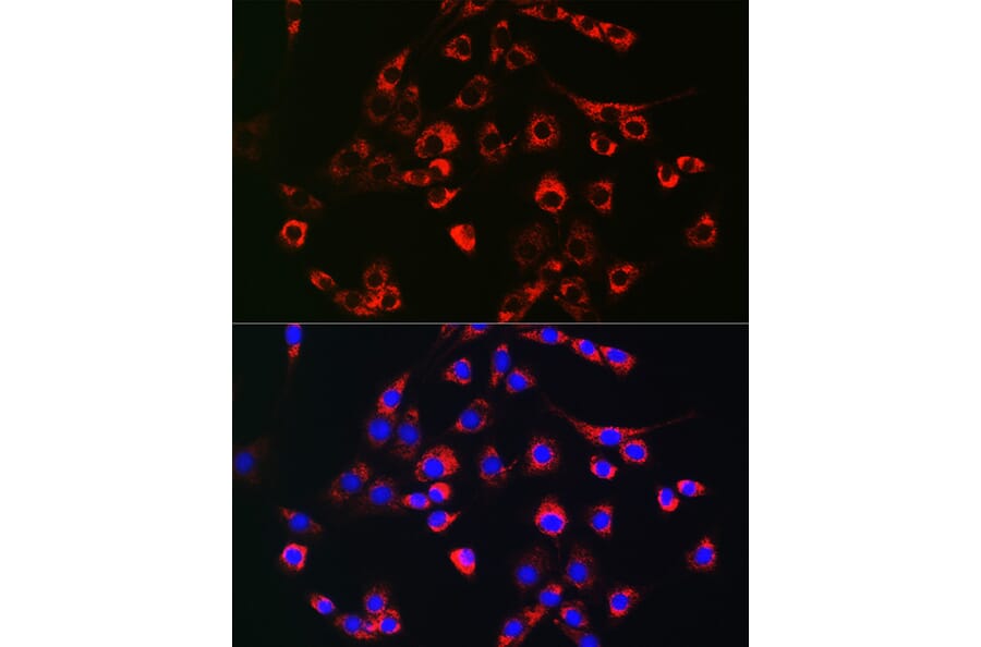 Immunofluorescence - Anti-PMP70 Antibody (A306728) - Antibodies.com