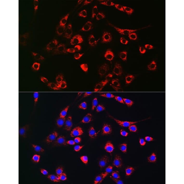 Immunofluorescence - Anti-PMP70 Antibody (A306728) - Antibodies.com