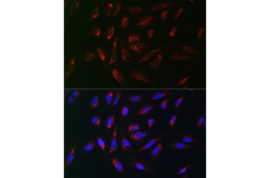Immunofluorescence - Anti-PMP70 Antibody (A306728) - Antibodies.com