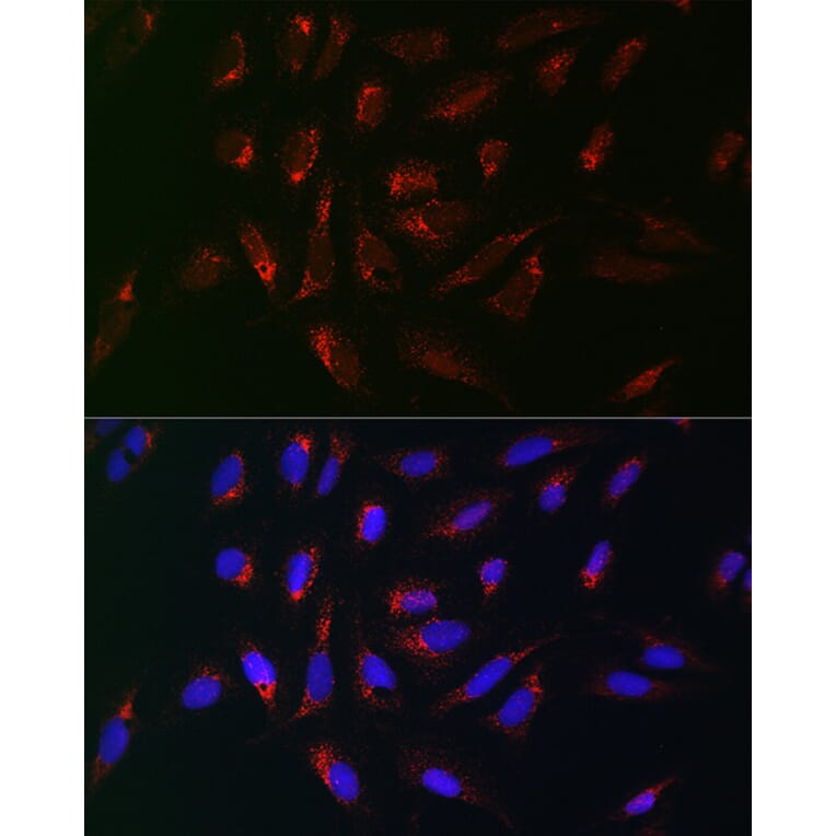 Immunofluorescence - Anti-PMP70 Antibody (A306728) - Antibodies.com