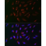 Immunofluorescence - Anti-PMP70 Antibody (A306728) - Antibodies.com