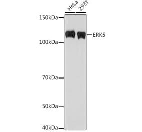 Western Blot - Anti-ERK5 Antibody [ARC0871] (A306729) - Antibodies.com