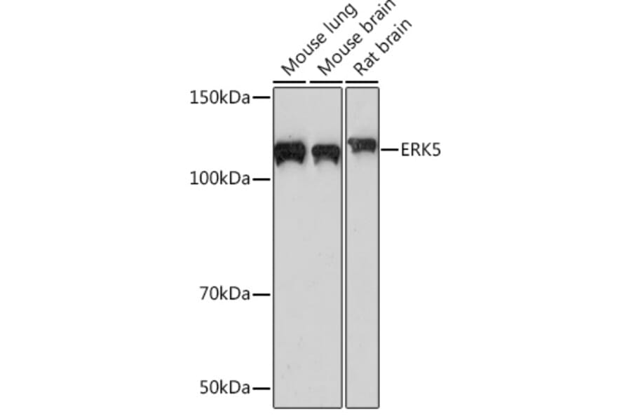 Western Blot - Anti-ERK5 Antibody [ARC0871] (A306729) - Antibodies.com