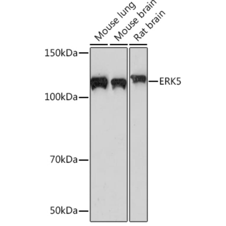 Western Blot - Anti-ERK5 Antibody [ARC0871] (A306729) - Antibodies.com