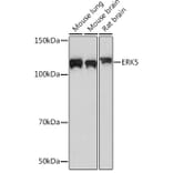 Western Blot - Anti-ERK5 Antibody [ARC0871] (A306729) - Antibodies.com