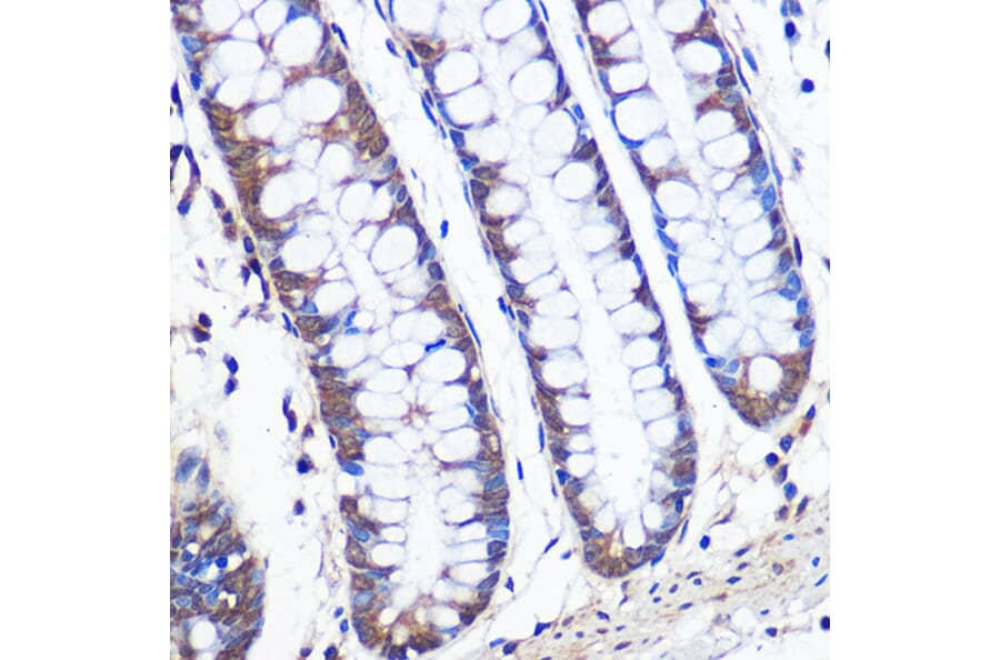 Immunohistochemistry - Anti-ERK5 Antibody [ARC0871] (A306729) - Antibodies.com