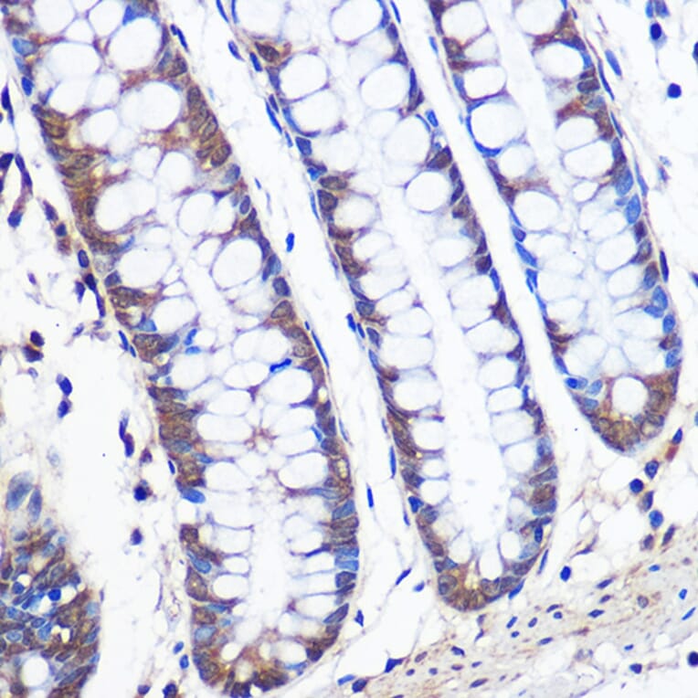 Immunohistochemistry - Anti-ERK5 Antibody [ARC0871] (A306729) - Antibodies.com