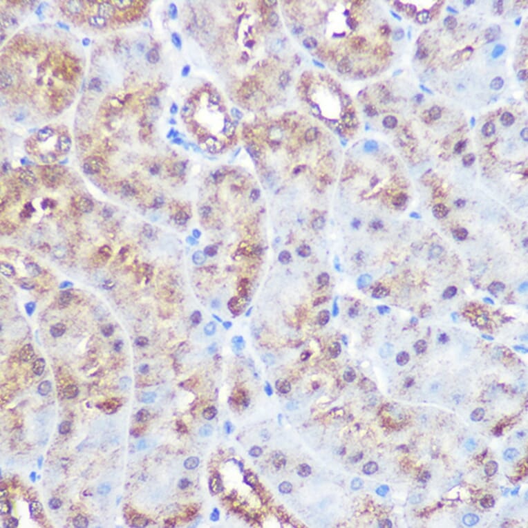 Immunohistochemistry - Anti-ERK5 Antibody [ARC0871] (A306729) - Antibodies.com