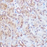 Immunohistochemistry - Anti-ERK5 Antibody [ARC0871] (A306729) - Antibodies.com