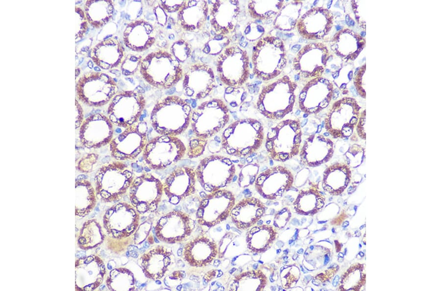 Immunohistochemistry - Anti-ERK5 Antibody [ARC0871] (A306729) - Antibodies.com