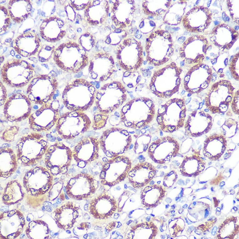 Immunohistochemistry - Anti-ERK5 Antibody [ARC0871] (A306729) - Antibodies.com
