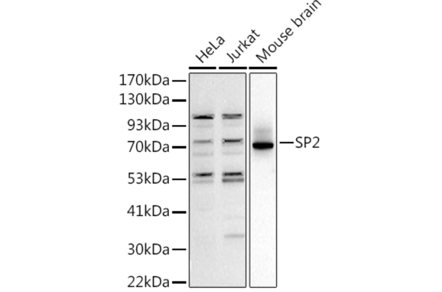 Western Blot - Anti-SP2 transcription factor Antibody (A306730) - Antibodies.com