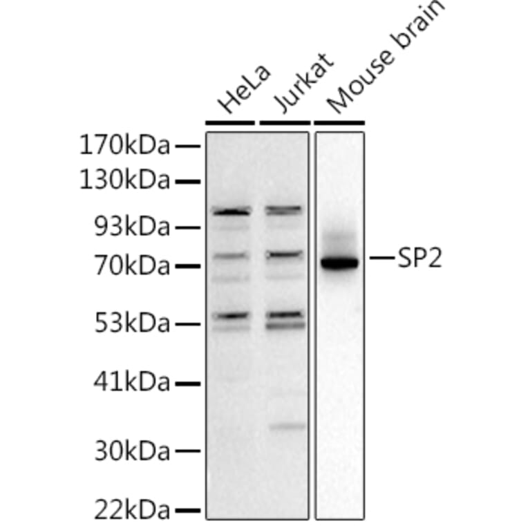 Western Blot - Anti-SP2 transcription factor Antibody (A306730) - Antibodies.com