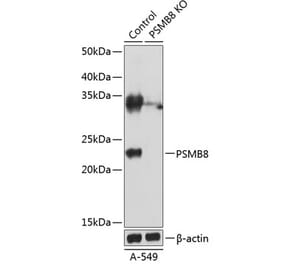Western Blot - Anti-Proteasome 20S LMP7 Antibody (A306731) - Antibodies.com