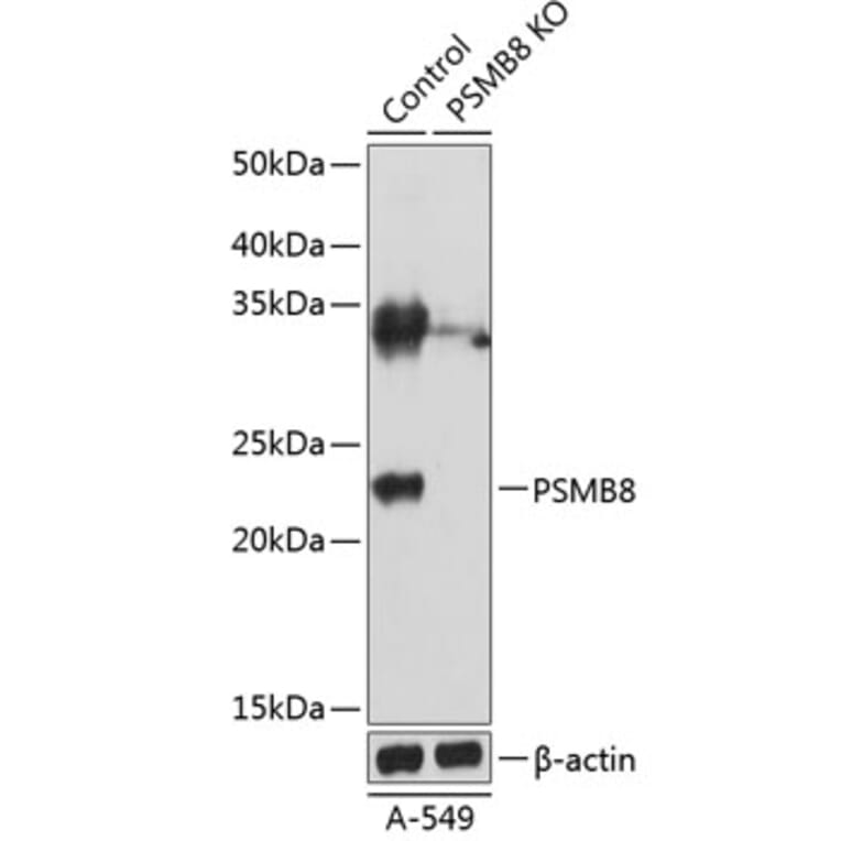 Western Blot - Anti-Proteasome 20S LMP7 Antibody (A306731) - Antibodies.com