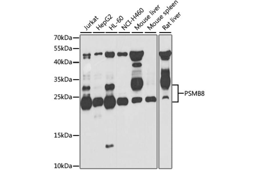 Western Blot - Anti-Proteasome 20S LMP7 Antibody (A306732) - Antibodies.com