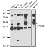 Western Blot - Anti-Proteasome 20S LMP7 Antibody (A306732) - Antibodies.com