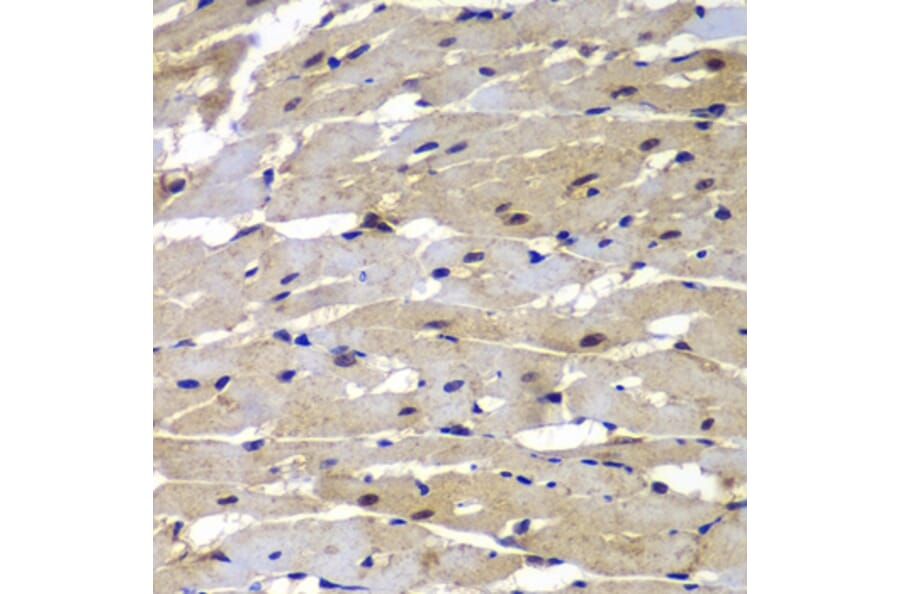Immunohistochemistry - Anti-Proteasome 20S LMP7 Antibody (A306732) - Antibodies.com