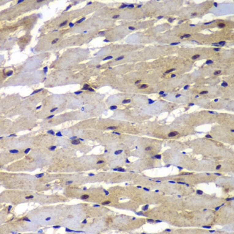 Immunohistochemistry - Anti-Proteasome 20S LMP7 Antibody (A306732) - Antibodies.com