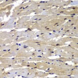 Immunohistochemistry - Anti-Proteasome 20S LMP7 Antibody (A306732) - Antibodies.com