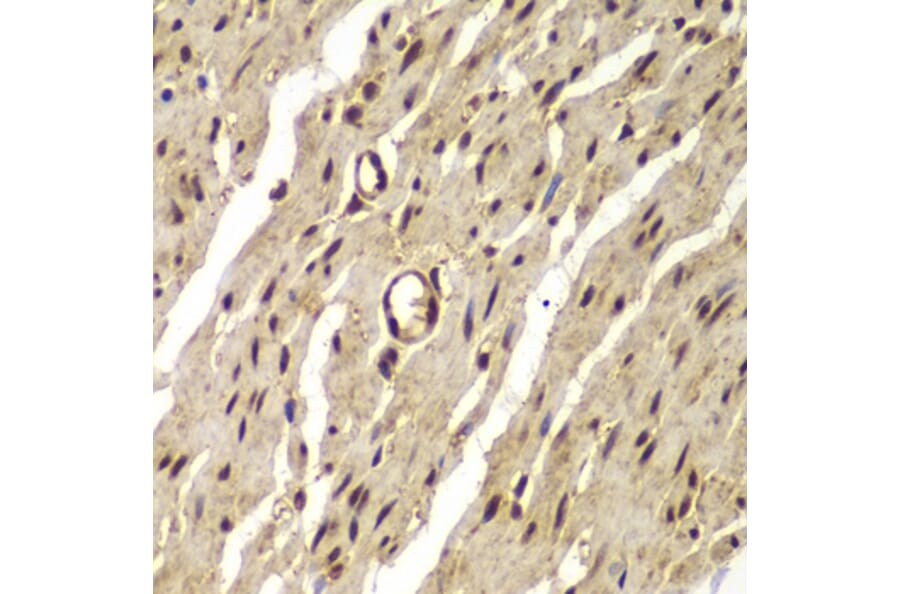 Immunohistochemistry - Anti-Proteasome 20S LMP7 Antibody (A306732) - Antibodies.com