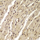 Immunohistochemistry - Anti-Proteasome 20S LMP7 Antibody (A306732) - Antibodies.com