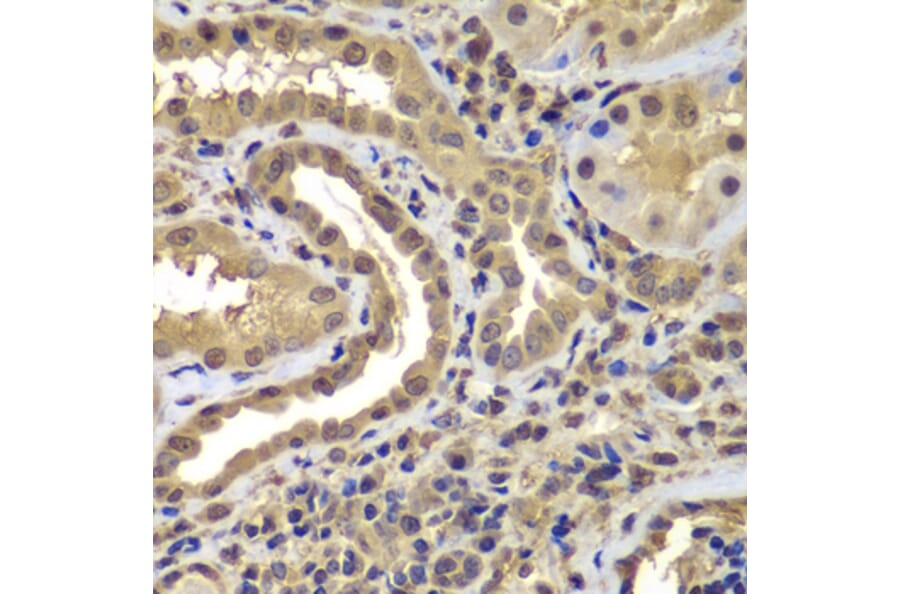 Immunohistochemistry - Anti-Proteasome 20S LMP7 Antibody (A306732) - Antibodies.com