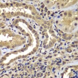 Immunohistochemistry - Anti-Proteasome 20S LMP7 Antibody (A306732) - Antibodies.com