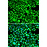 Immunofluorescence - Anti-Proteasome 20S LMP7 Antibody (A306732) - Antibodies.com