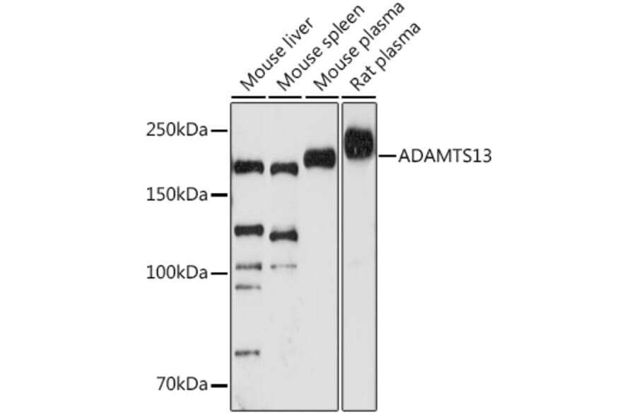 Western Blot - Anti-ADAMTS13 Antibody [ARC1957] (A306733) - Antibodies.com