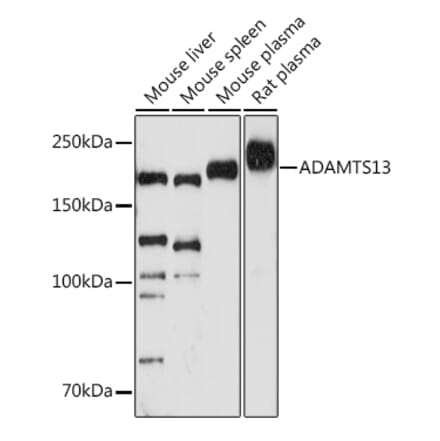 Western Blot - Anti-ADAMTS13 Antibody [ARC1957] (A306733) - Antibodies.com