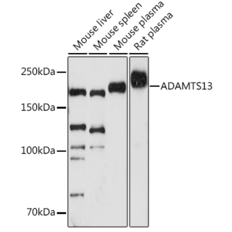 Western Blot - Anti-ADAMTS13 Antibody [ARC1957] (A306733) - Antibodies.com