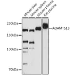 Western Blot - Anti-ADAMTS13 Antibody [ARC1957] (A306733) - Antibodies.com