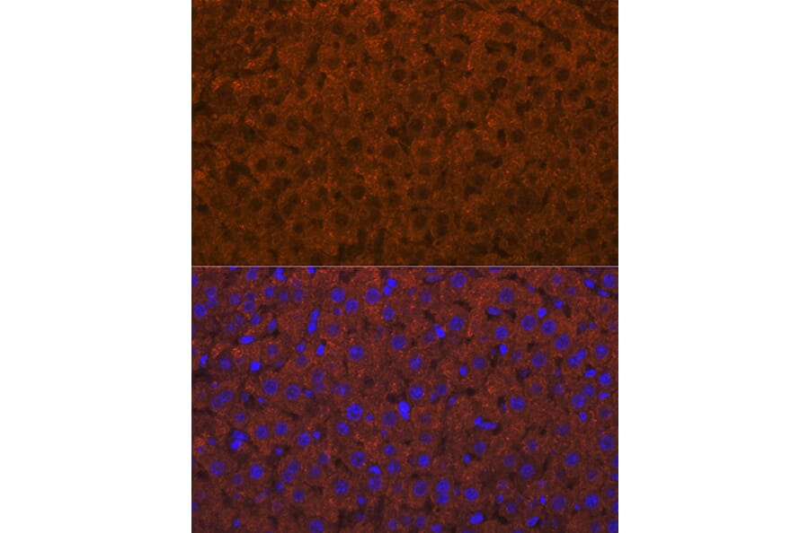 Immunofluorescence - Anti-ADAMTS13 Antibody [ARC1957] (A306733) - Antibodies.com