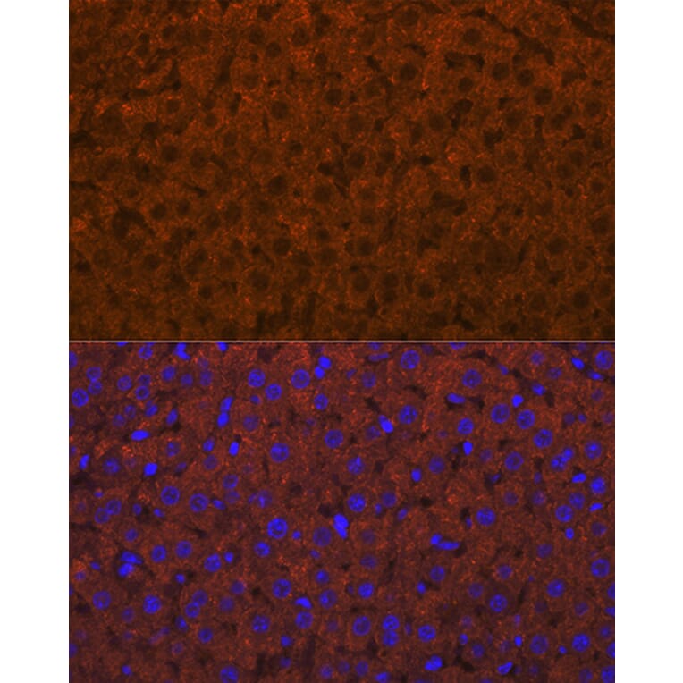 Immunofluorescence - Anti-ADAMTS13 Antibody [ARC1957] (A306733) - Antibodies.com