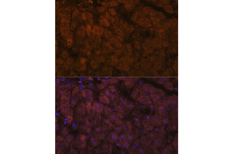 Immunofluorescence - Anti-ADAMTS13 Antibody [ARC1957] (A306733) - Antibodies.com