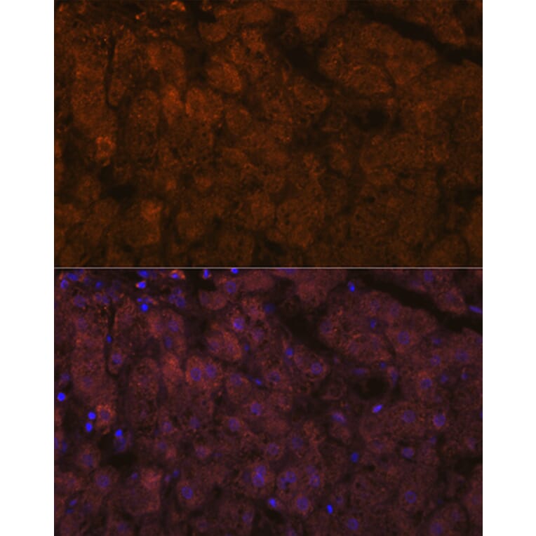 Immunofluorescence - Anti-ADAMTS13 Antibody [ARC1957] (A306733) - Antibodies.com