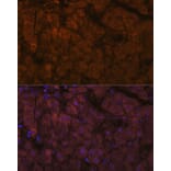 Immunofluorescence - Anti-ADAMTS13 Antibody [ARC1957] (A306733) - Antibodies.com