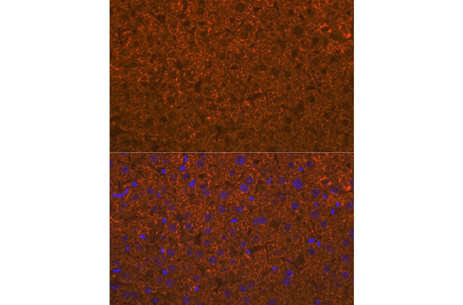 Immunofluorescence - Anti-ADAMTS13 Antibody [ARC1957] (A306733) - Antibodies.com