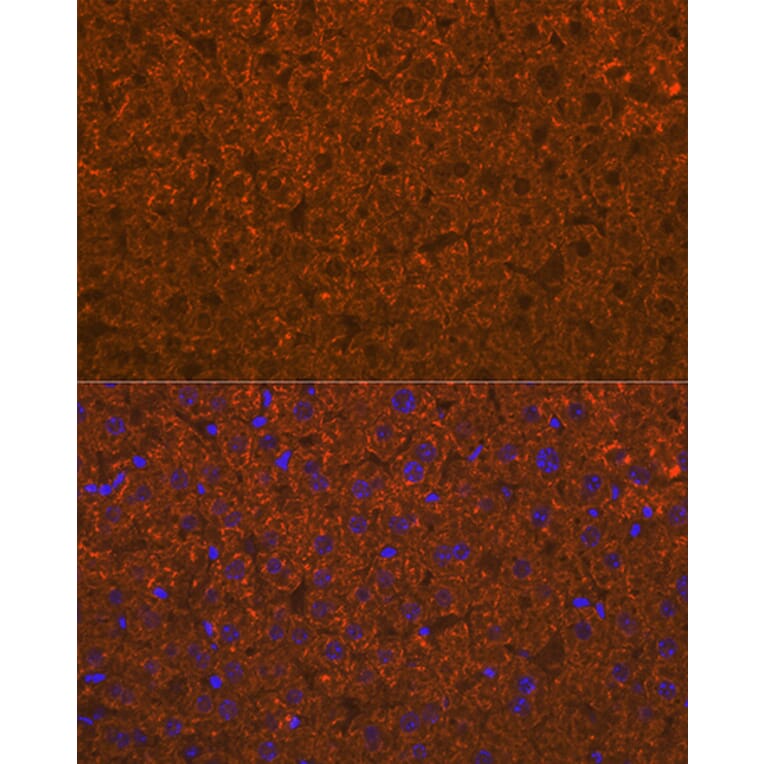 Immunofluorescence - Anti-ADAMTS13 Antibody [ARC1957] (A306733) - Antibodies.com