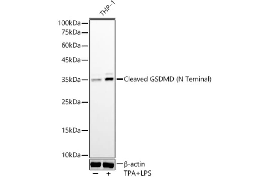 Western Blot - Anti-Cleaved GSDMD Antibody [ARC57994] (A306734) - Antibodies.com