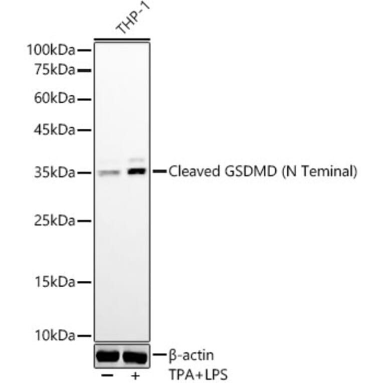 Western Blot - Anti-Cleaved GSDMD Antibody [ARC57994] (A306734) - Antibodies.com
