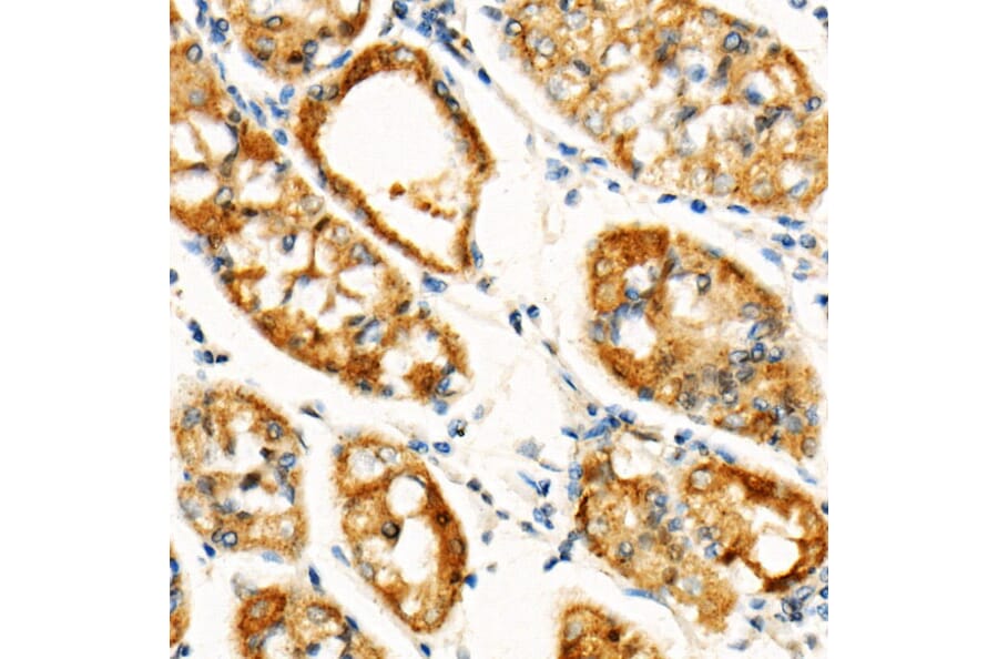 Immunohistochemistry - Anti-Cleaved GSDMD Antibody [ARC57994] (A306734) - Antibodies.com