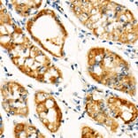 Immunohistochemistry - Anti-Cleaved GSDMD Antibody [ARC57994] (A306734) - Antibodies.com